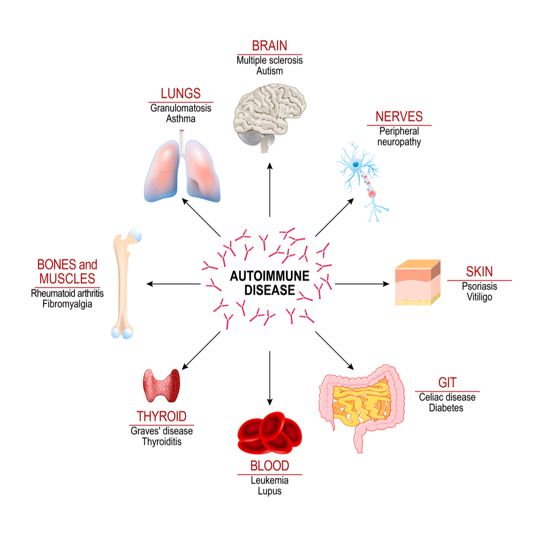 What is Autoimmune Disease   Daiwa Health Development, Inc.